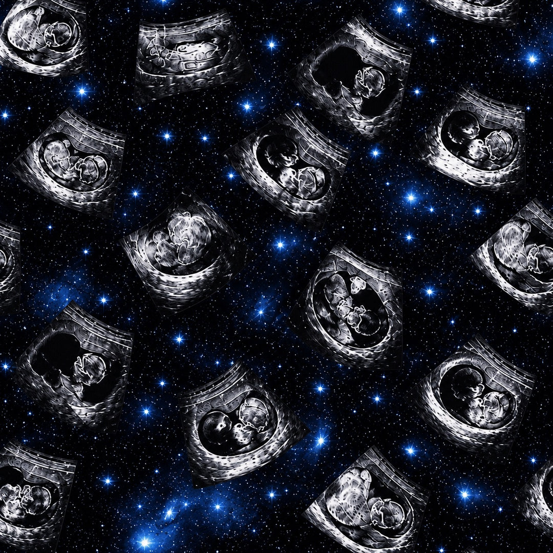 Custom ultrasound galaxy fabric print swatch, black and white ultrasound photos scattered across a starry night sky background for OR World custom photo scrub caps.